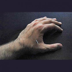 hand_with_needle