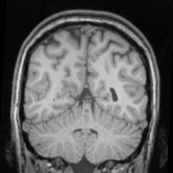 brain_cross_section_scan